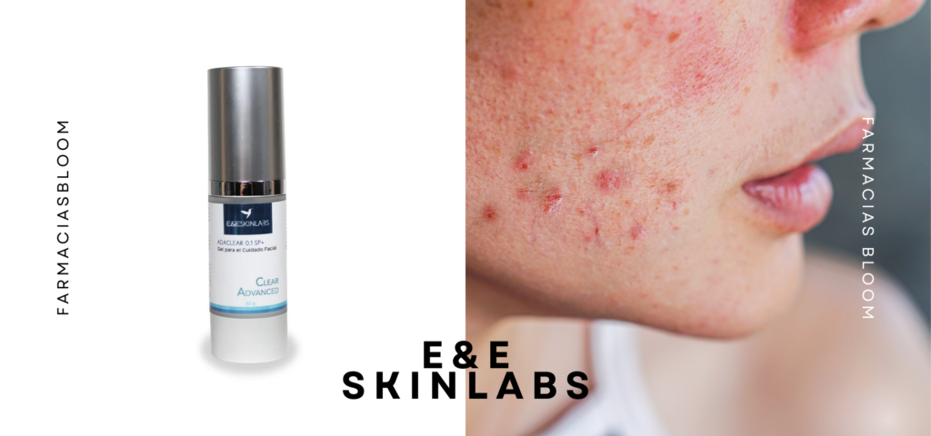 Cuida tu piel día a día con E&E SkinLabs: De acné a hidratación completa 💧 3
